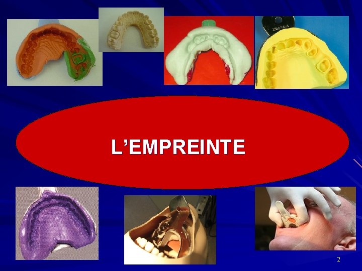 L’EMPREINTE 2 