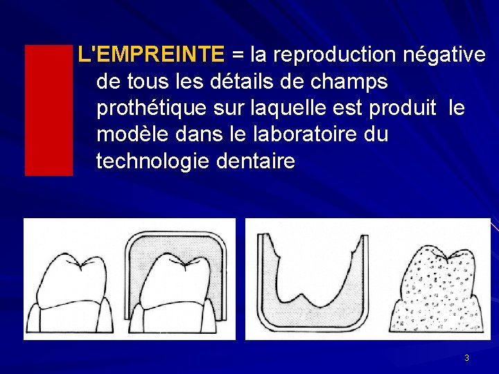 L'EMPREINTE = la reproduction négative de tous les détails de champs prothétique sur laquelle