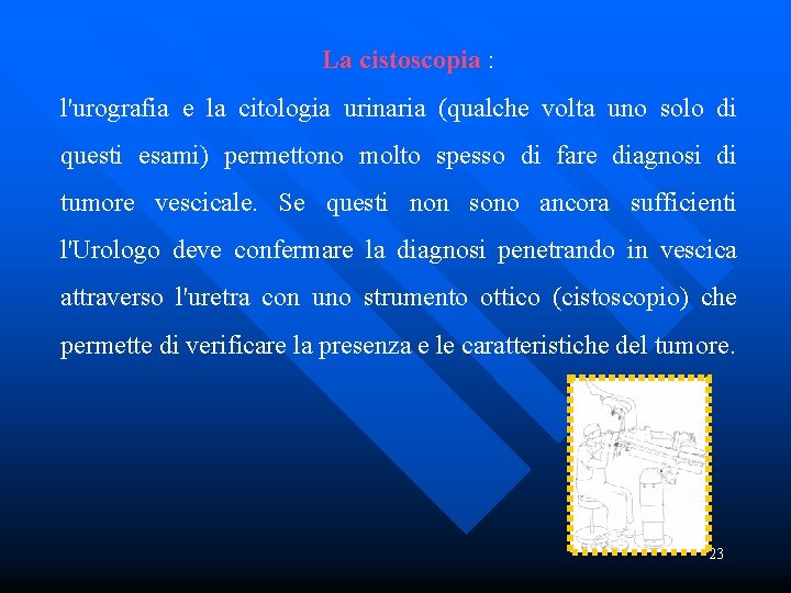  La cistoscopia : l'urografia e la citologia urinaria (qualche volta uno solo di