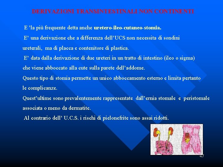  DERIVAZIONI TRANSINTESTINALI NON CONTINENTI E ’la più frequente detta anche uretero-ileo-cutaneo-stomia. E’ una