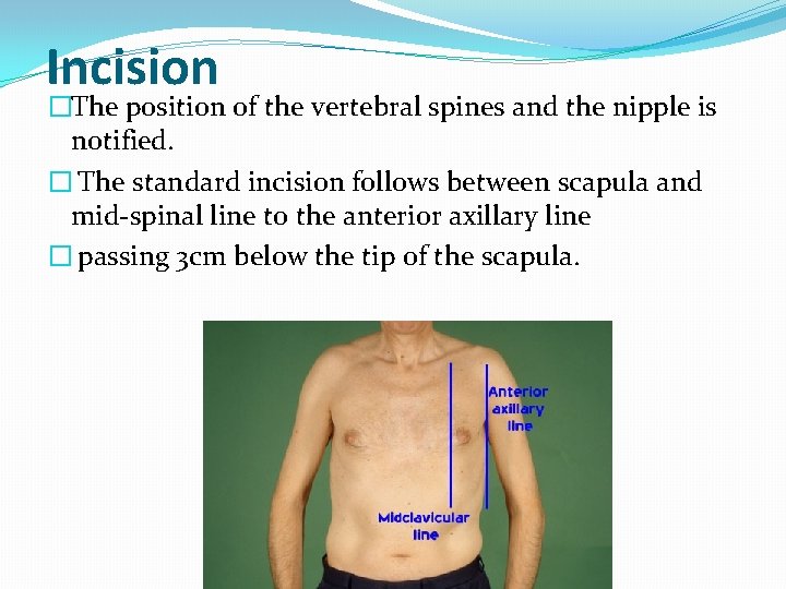 Incision �The position of the vertebral spines and the nipple is notified. � The