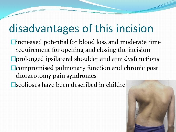 disadvantages of this incision �increased potential for blood loss and moderate time requirement for