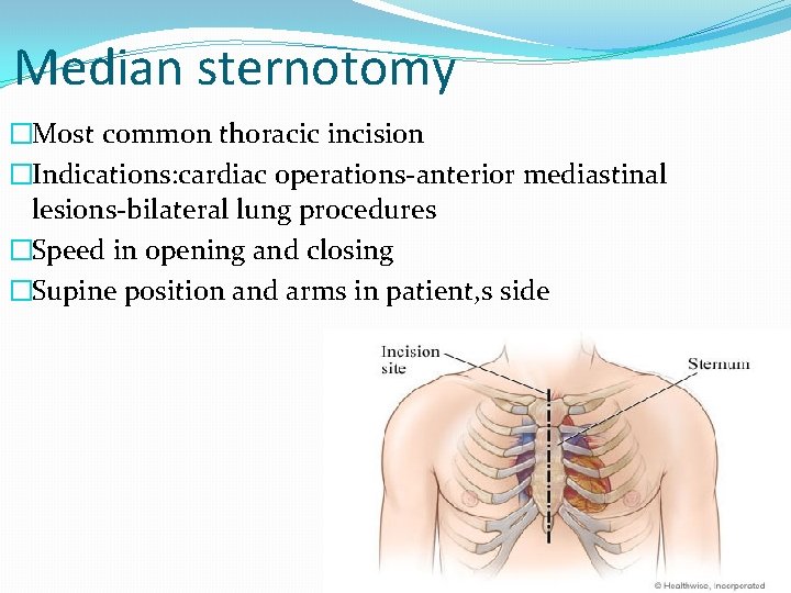 Median sternotomy �Most common thoracic incision �Indications: cardiac operations-anterior mediastinal lesions-bilateral lung procedures �Speed