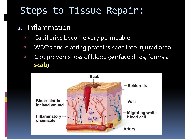 Steps to Tissue Repair: 1. Inflammation Capillaries become very permeable WBC’s and clotting proteins