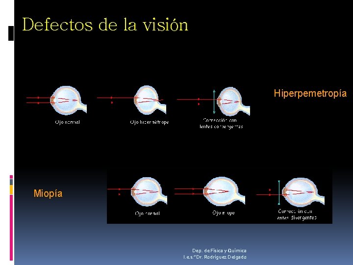 Defectos de la visión Hiperpemetropía Miopía Dep. de Física y Química I. e. s.