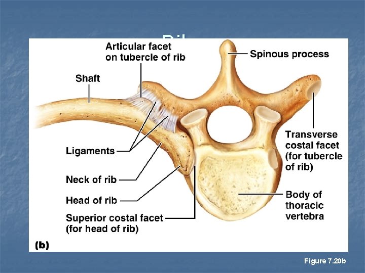 Ribs Figure 7. 20 b 