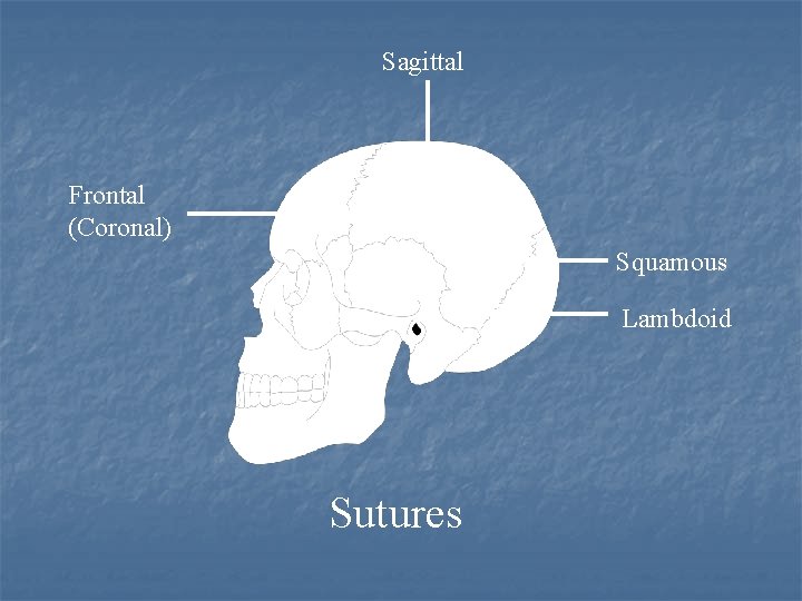 Sagittal Frontal (Coronal) Squamous Lambdoid Sutures 