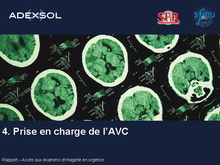 4. Prise en charge de l’AVC Rapport – Accès aux examens d’imagerie en urgence