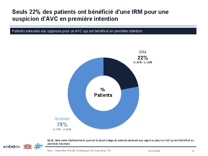 Seuls 22% des patients ont bénéficié d’une IRM pour une suspicion d’AVC en première