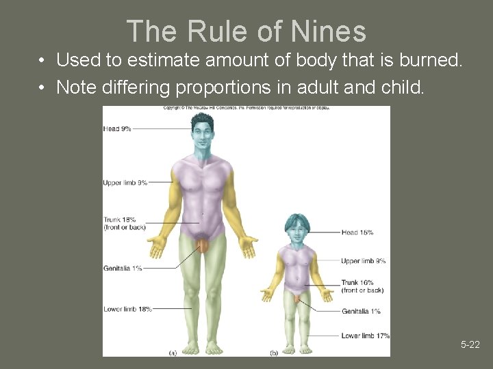 The Rule of Nines • Used to estimate amount of body that is burned.