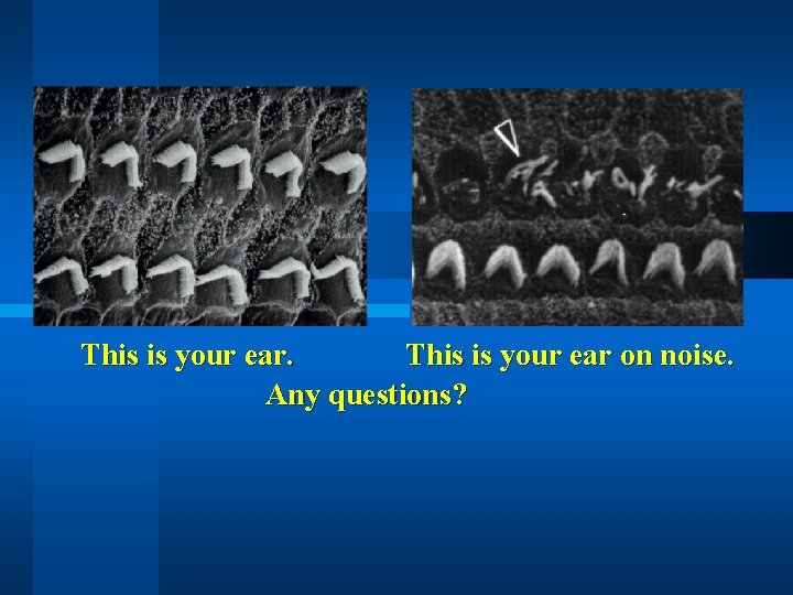 This is your ear on noise. Any questions? 