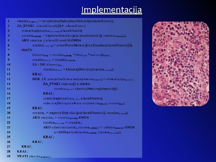 Implementacija 