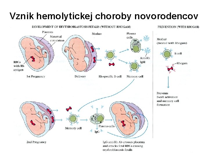 Vznik hemolytickej choroby novorodencov 