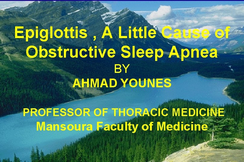 Epiglottis , A Little Cause of Obstructive Sleep Apnea BY AHMAD YOUNES PROFESSOR OF