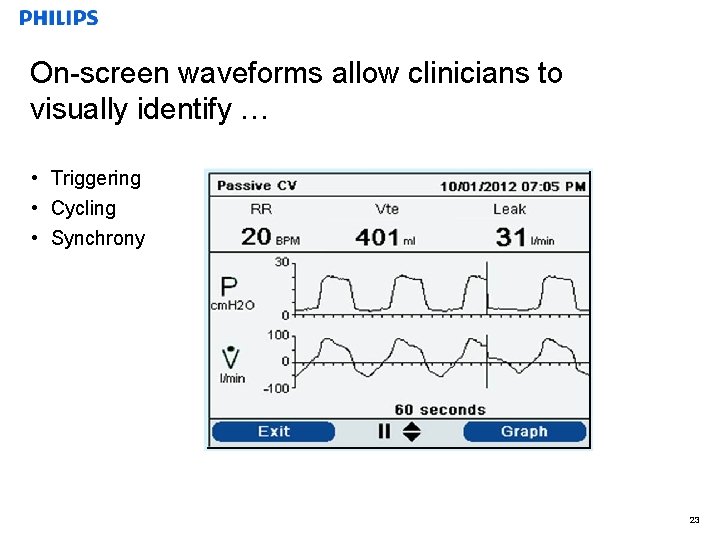 On-screen waveforms allow clinicians to visually identify … • Triggering • Cycling • Synchrony
