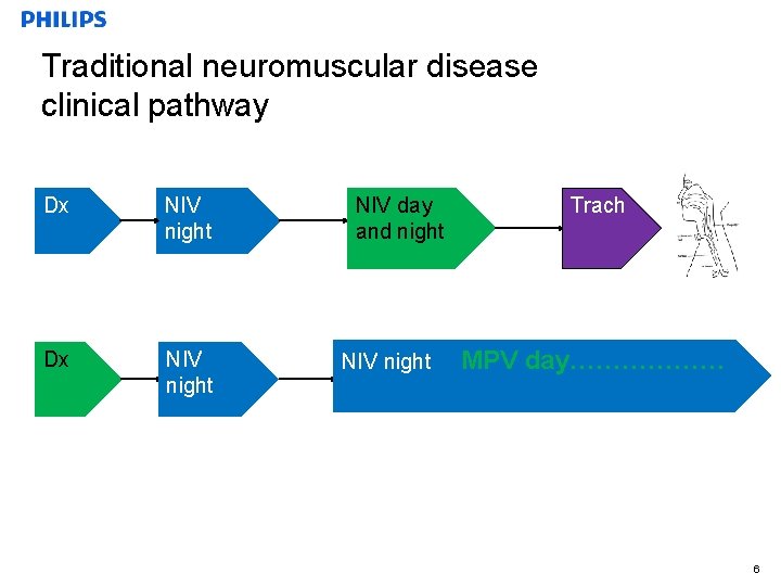 Traditional neuromuscular disease clinical pathway Dx NIV night Confidential NIV day and night NIV