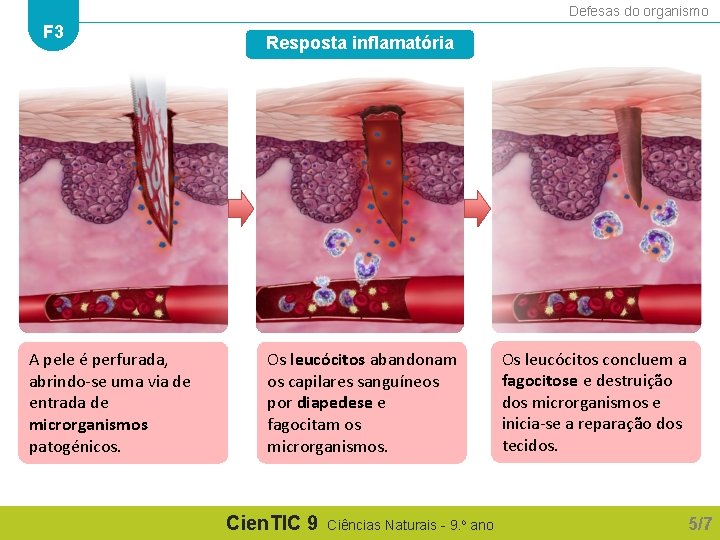 Defesas do organismo F 3 A pele é perfurada, abrindo-se uma via de entrada