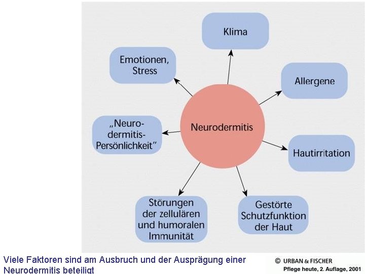 Viele Faktoren sind am Ausbruch und der Ausprägung einer Neurodermitis beteiligt 