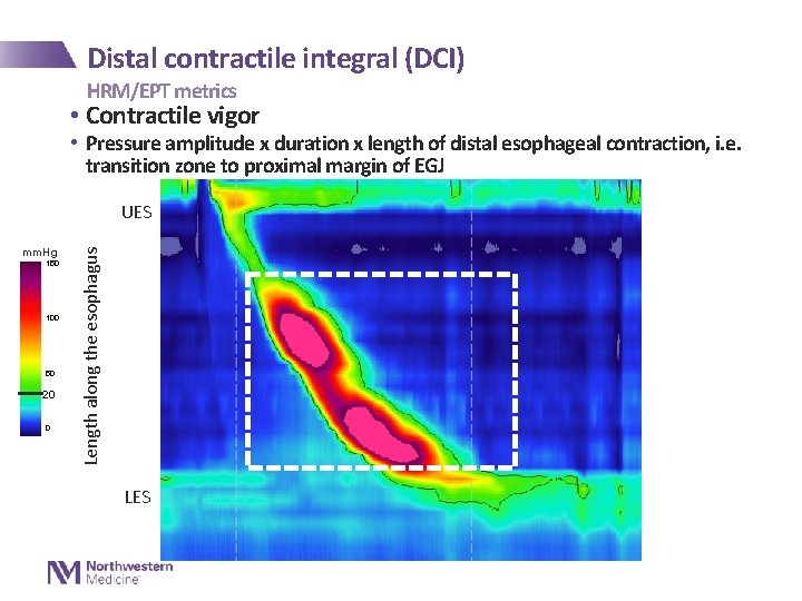 Distal contractile integral (DCI) HRM/EPT metrics • Contractile vigor • Pressure amplitude x duration