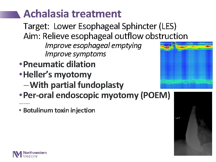 Achalasia treatment Target: Lower Esophageal Sphincter (LES) Aim: Relieve esophageal outflow obstruction Improve esophageal