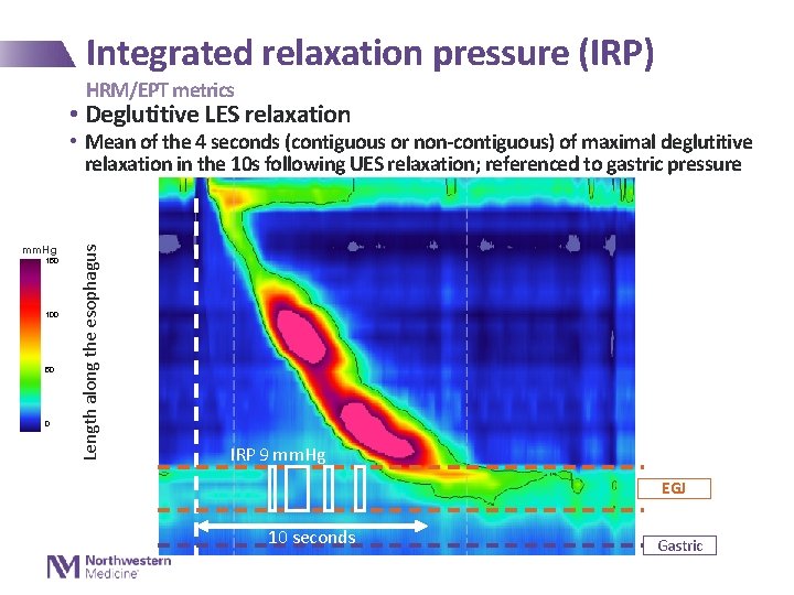 Integrated relaxation pressure (IRP) HRM/EPT metrics • Deglutitive LES relaxation mm. Hg 150 100