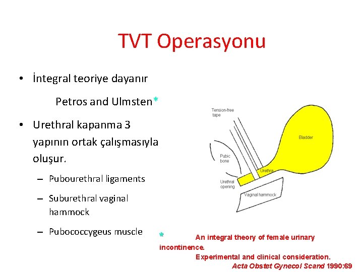 TVT Operasyonu • İntegral teoriye dayanır Petros and Ulmsten* • Urethral kapanma 3 yapının