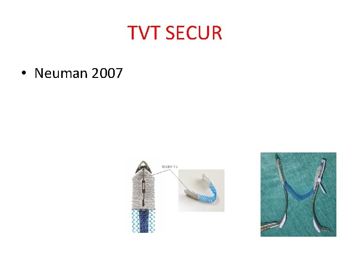 TVT SECUR • Neuman 2007 