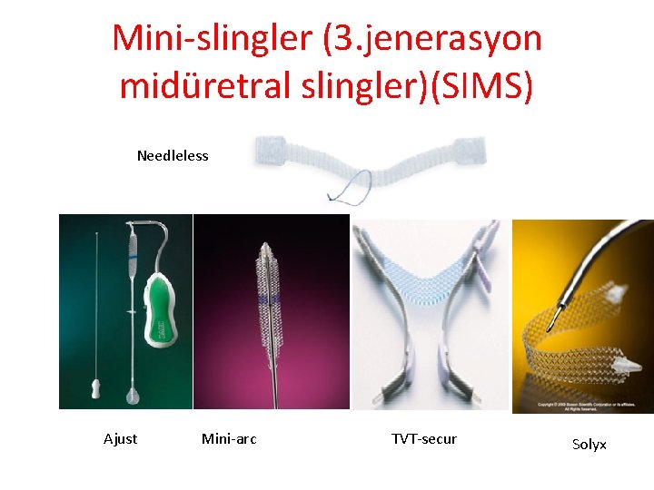 Mini-slingler (3. jenerasyon midüretral slingler)(SIMS) Needleless Ajust Mini-arc TVT-secur Solyx 