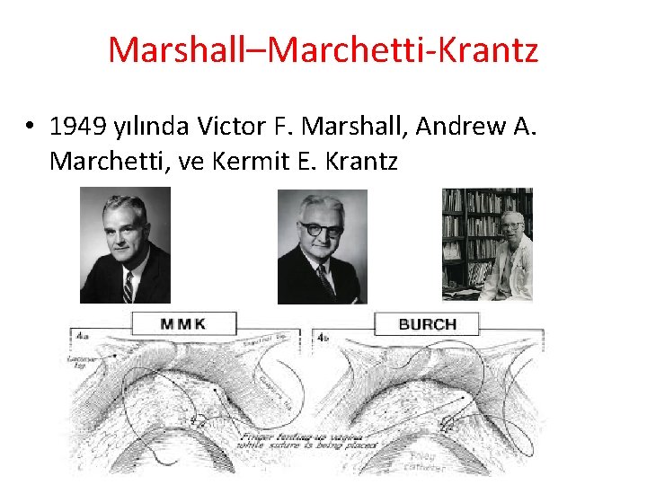 Marshall–Marchetti-Krantz • 1949 yılında Victor F. Marshall, Andrew A. Marchetti, ve Kermit E. Krantz