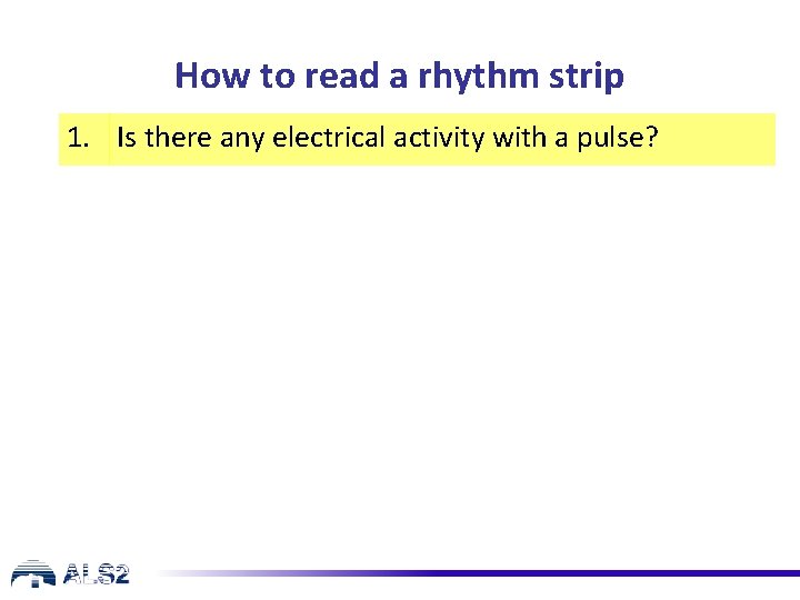 How to read a rhythm strip 1. Is there any electrical activity with a How to read a rhythm strip 1. Is there any electrical activity with a