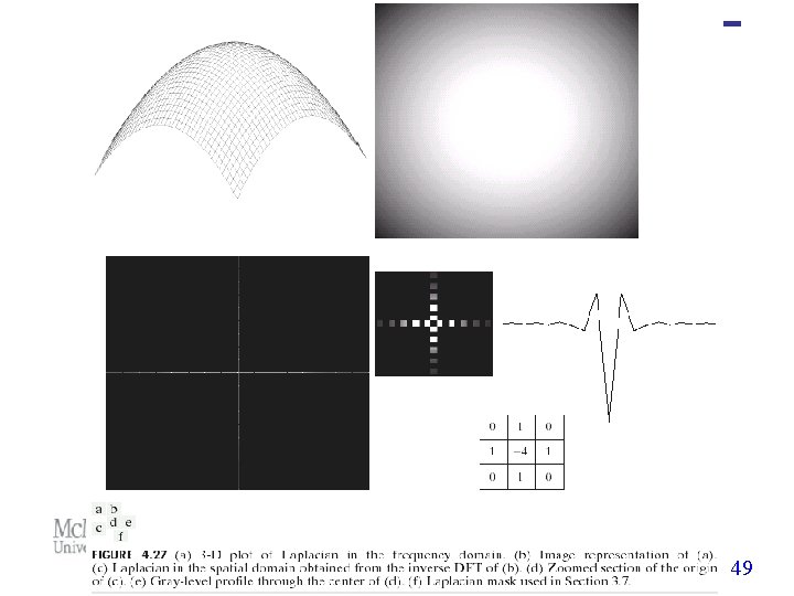 Eng 4 Bf 3 Medical Image Processing Image