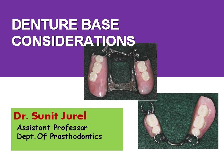 DENTURE BASE CONSIDERATIONS Dr. Sunit Jurel Assistant Professor Dept. Of Prosthodontics 