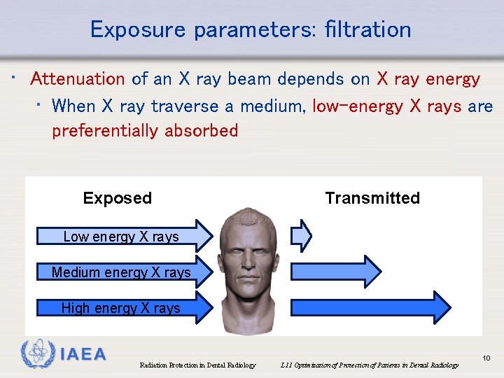 Exposure parameters: filtration • Attenuation of an X ray beam depends on X ray