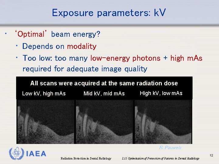 Exposure parameters: k. V • ‘Optimal’ beam energy? • Depends on modality • Too