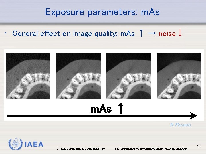Exposure parameters: m. As • General effect on image quality: m. As ↑ →