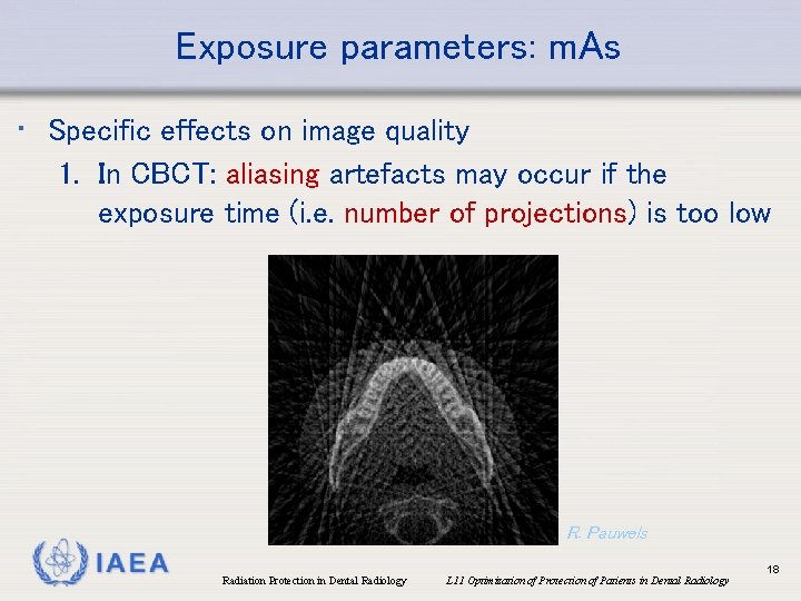 Exposure parameters: m. As • Specific effects on image quality 1. In CBCT: aliasing