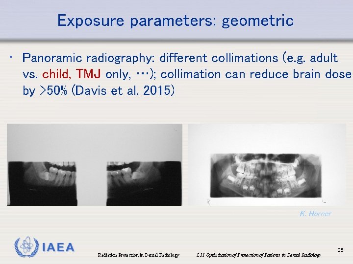 Exposure parameters: geometric • Panoramic radiography: different collimations (e. g. adult vs. child, TMJ