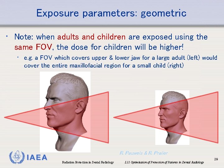 Exposure parameters: geometric • Note: when adults and children are exposed using the same