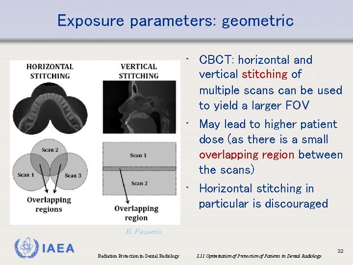 Exposure parameters: geometric • CBCT: horizontal and vertical stitching of multiple scans can be