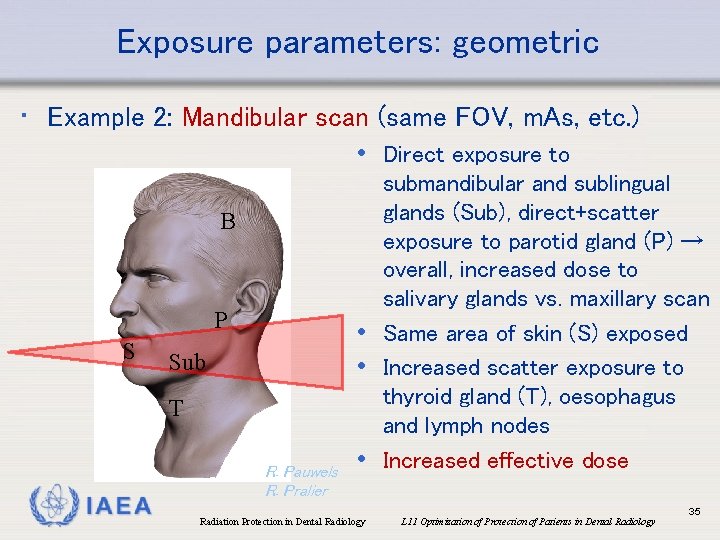 Exposure parameters: geometric • Example 2: Mandibular scan (same FOV, m. As, etc. )