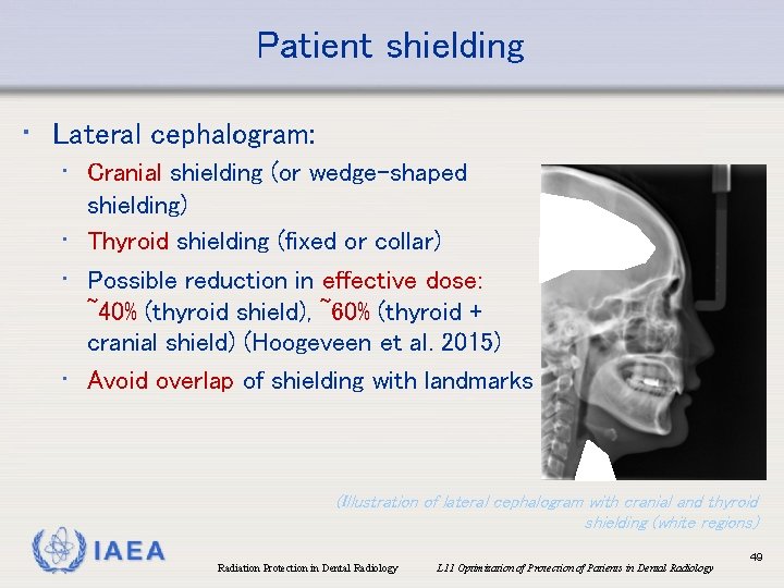 Patient shielding • Lateral cephalogram: • Cranial shielding (or wedge-shaped shielding) • Thyroid shielding