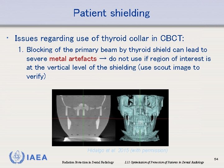 Patient shielding • Issues regarding use of thyroid collar in CBCT: 1. Blocking of