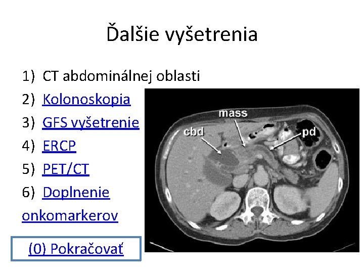 Ďalšie vyšetrenia 1) CT abdominálnej oblasti 2) Kolonoskopia 3) GFS vyšetrenie 4) ERCP 5)