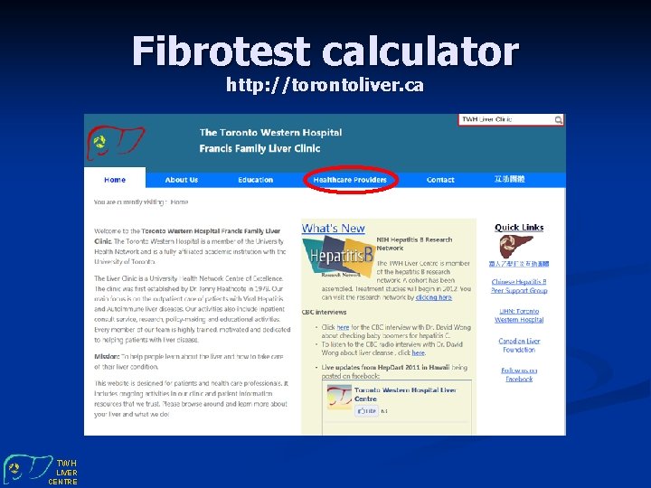Fibrotest calculator http: //torontoliver. ca TWH LIVER CENTRE 