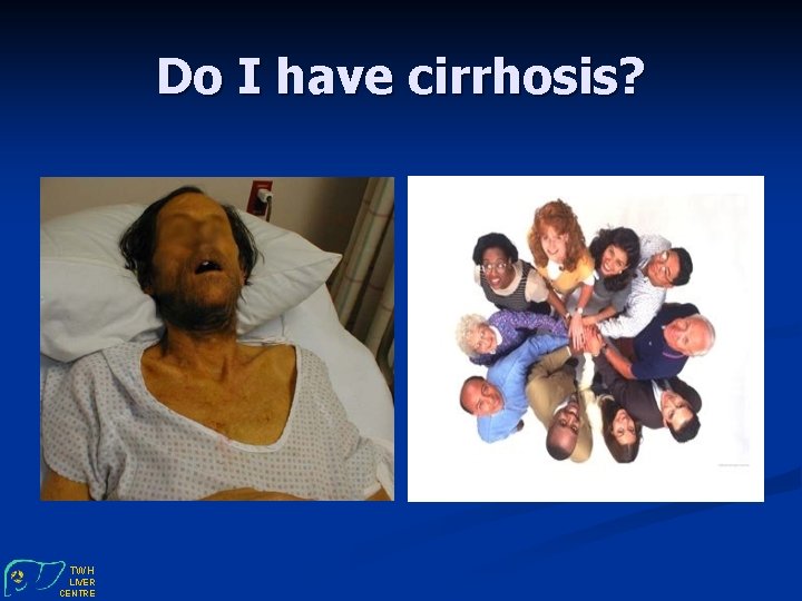 Do I have cirrhosis? TWH LIVER CENTRE 