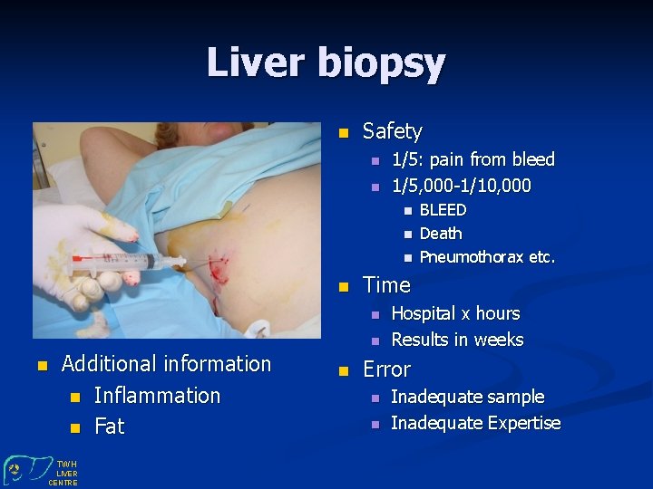 Liver biopsy n Safety n n 1/5: pain from bleed 1/5, 000 -1/10, 000