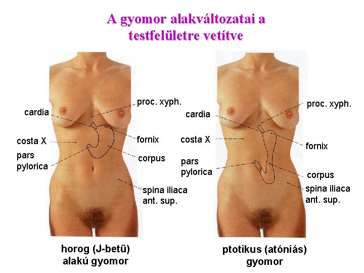 A gyomor alakváltozatai a testfelületre vetítve proc. xyph. cardia costa X fornix costa X