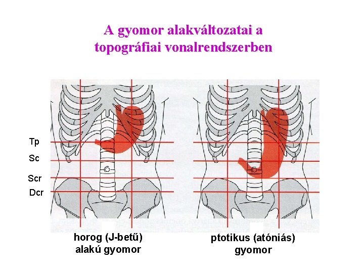 A gyomor alakváltozatai a topográfiai vonalrendszerben Tp Sc Scr Dcr horog (J-betű) alakú gyomor