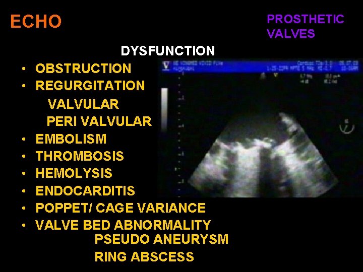 ECHO • • DYSFUNCTION OBSTRUCTION REGURGITATION VALVULAR PERI VALVULAR EMBOLISM THROMBOSIS HEMOLYSIS ENDOCARDITIS POPPET/