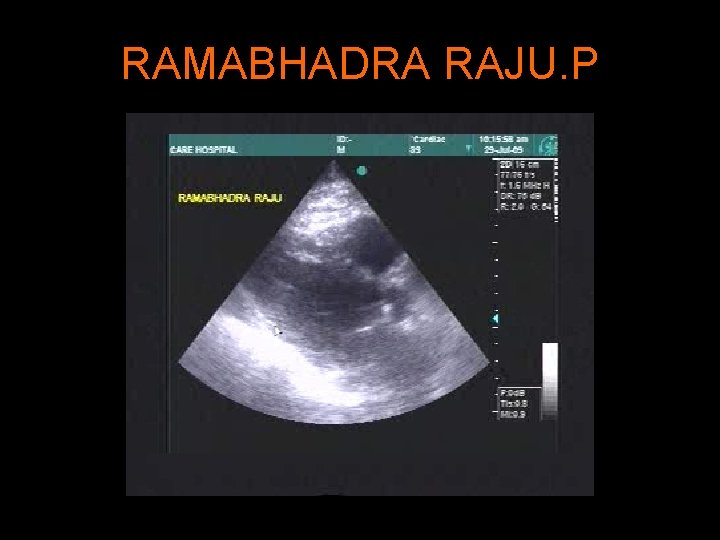 RAMABHADRA RAJU. P 